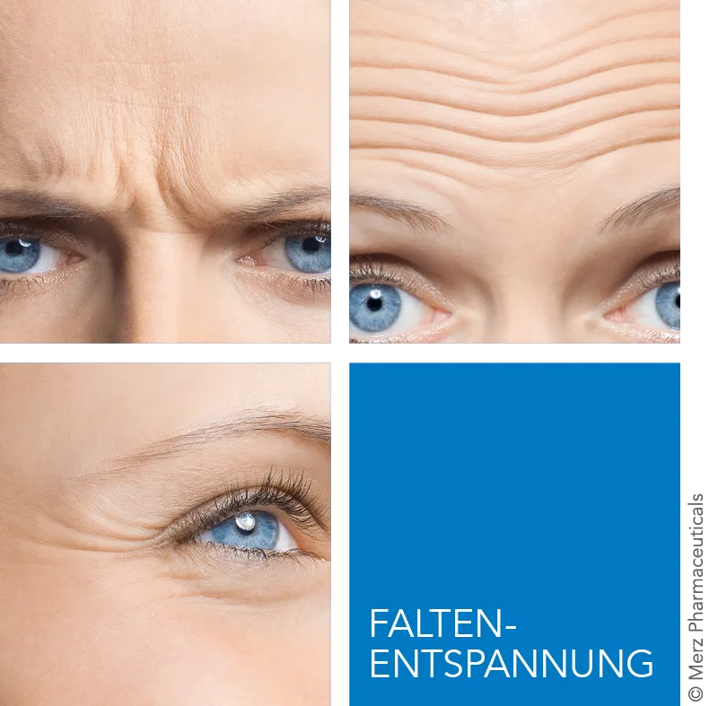 Faltenentspannung mit Botox®: Behandlungsbereiche Zornesfalte, Stirnfalten und Krähenfüße
